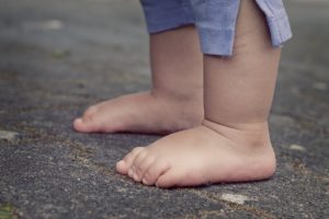 foot warts in kids
