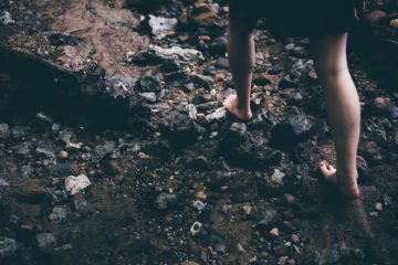 Hammertoe and Surgery
