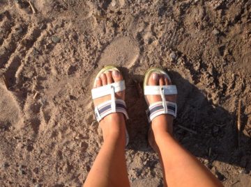 Hammertoes 101