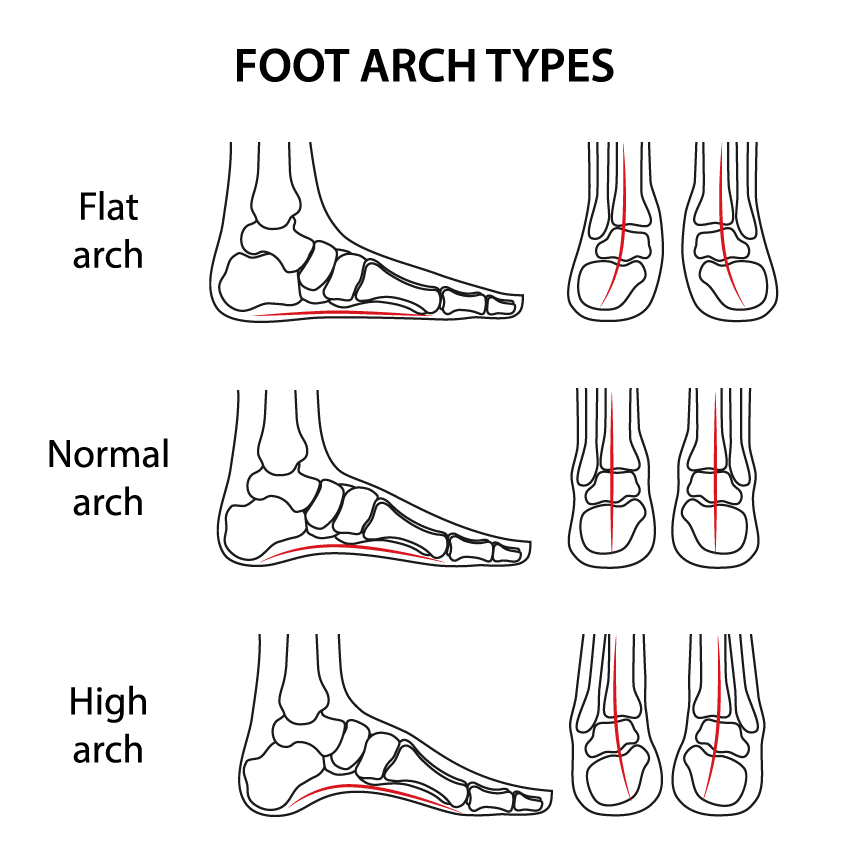 Flat arch on sale