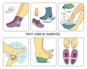 Foot Care Steps for Diabetics