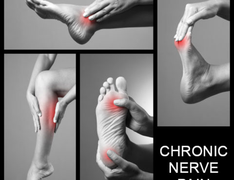 chronic-nerve-pain-apc