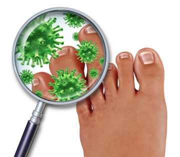 athlete's foot fungus treatment