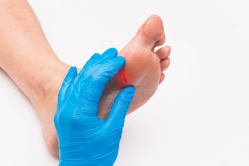 diabetic-foot-amputations-blog-pic-apc