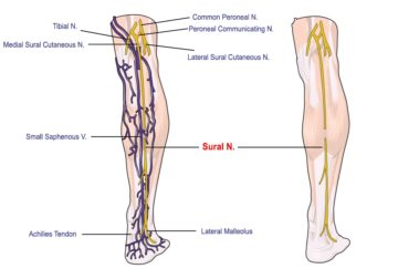 sural-nerve-pain-blog-anderson-podiatry-center