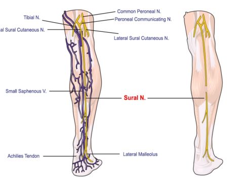 sural-nerve-pain-blog-anderson-podiatry-center