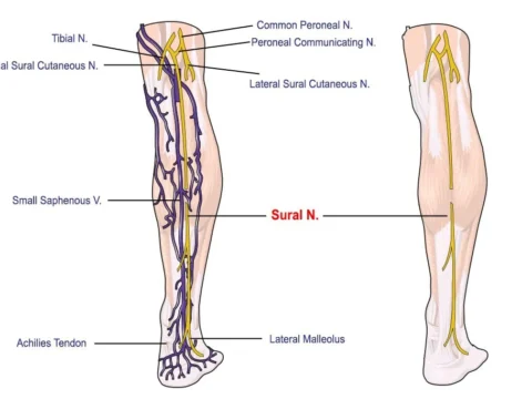 Sural Nerve Pain Anderson Podiatry Center