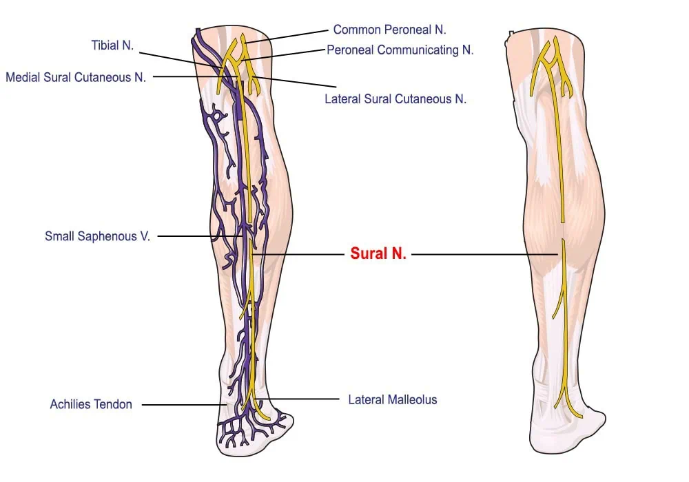 Sural Nerve Pain Anderson Podiatry Center