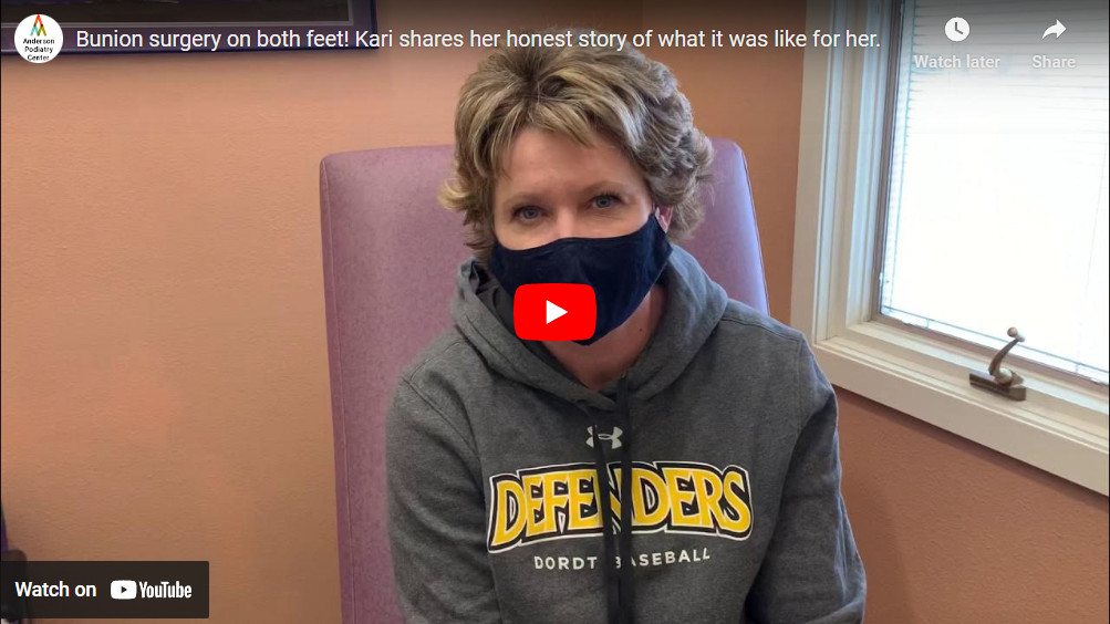 Bunion surgery on both feet! Kari shares her honest story of what it was like for her.