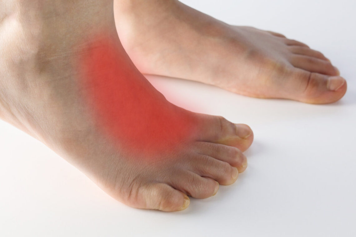 arthritis on top of foot