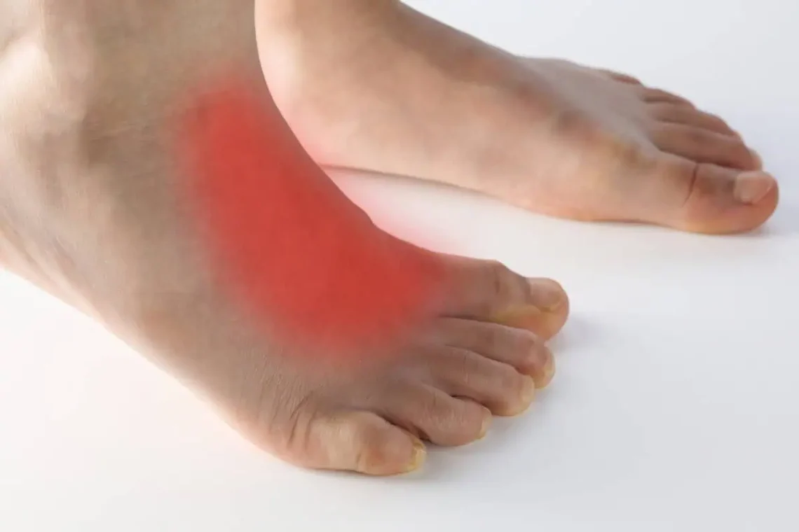 arthritis on top of foot