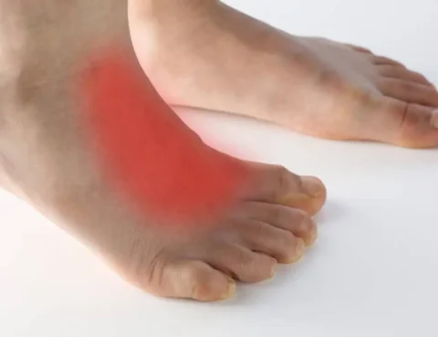 arthritis on top of foot