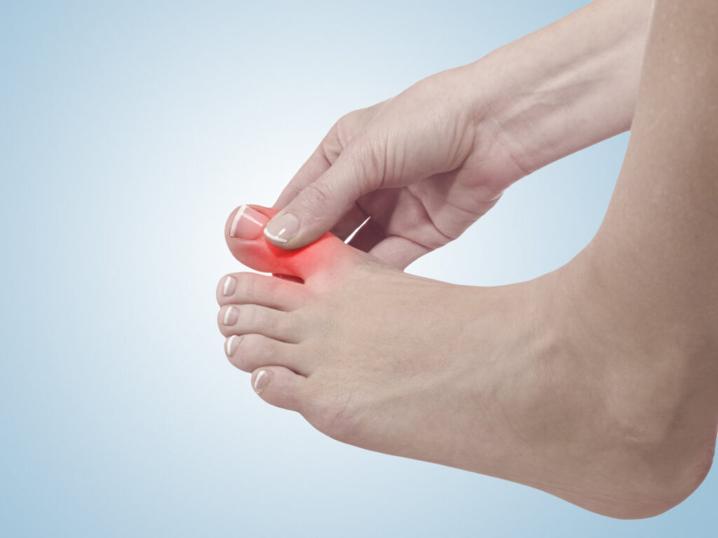 Cheilectomy surgery avoids big toe joint fusion or replacement?