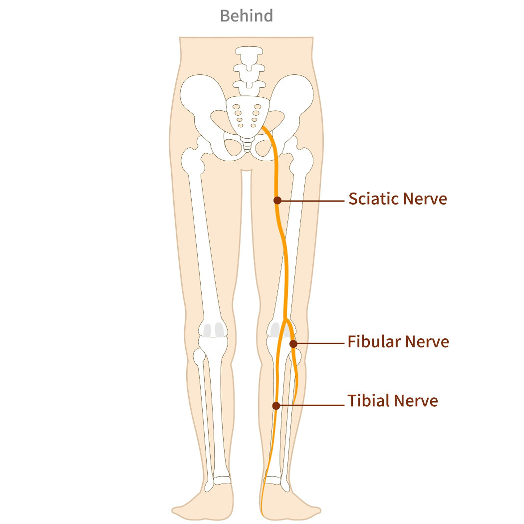 sciatica nerve infographic foot pain