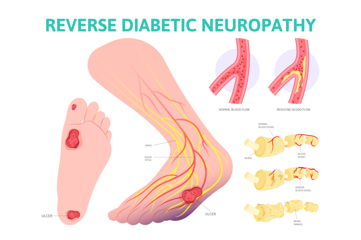 treatment for diabetic neuropathy