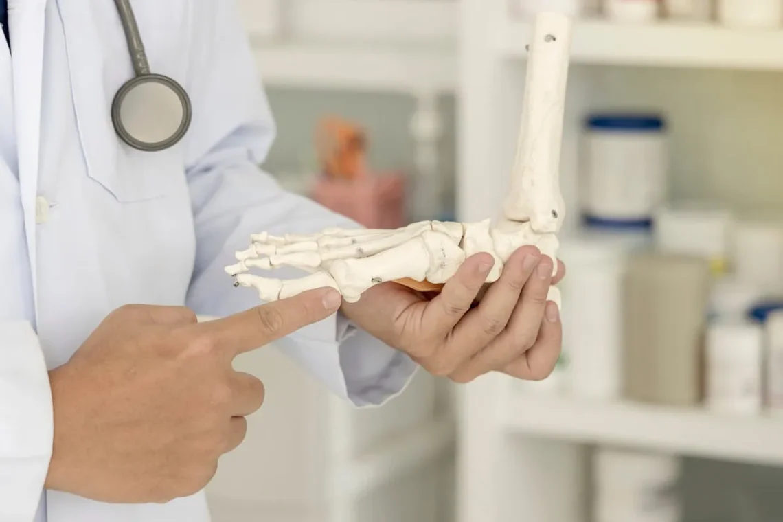 Bunion Surgery week by week