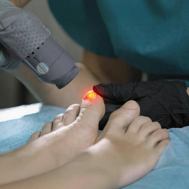 Heel Pain