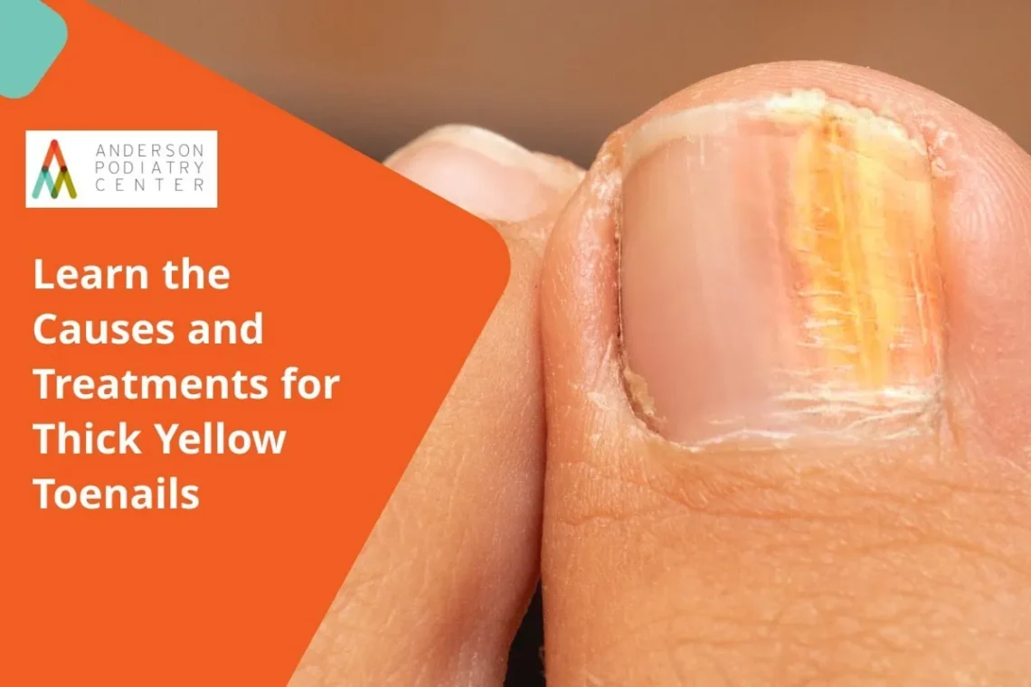 Thick Yellow Toenails