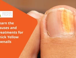 Thick Yellow Toenails