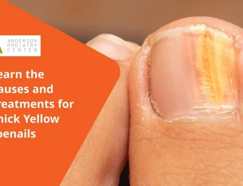 Thick Yellow Toenails
