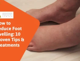 How to reduce foot swelling Edema