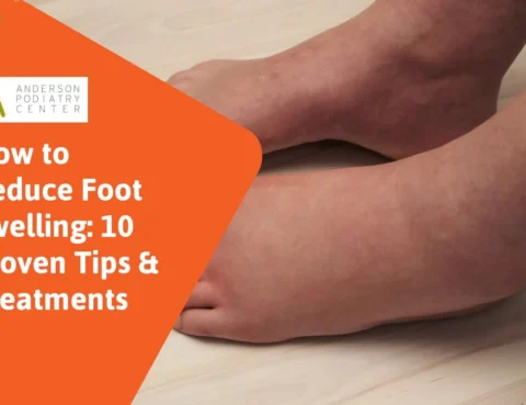 How to reduce foot swelling Edema